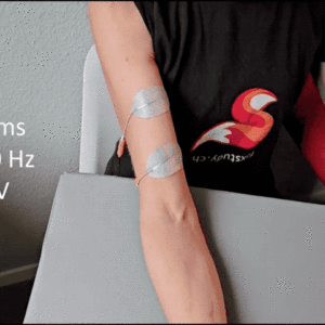 Understanding and using modern electrostimulation